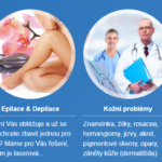 Aplikujte botox – a problém bude vyřešen